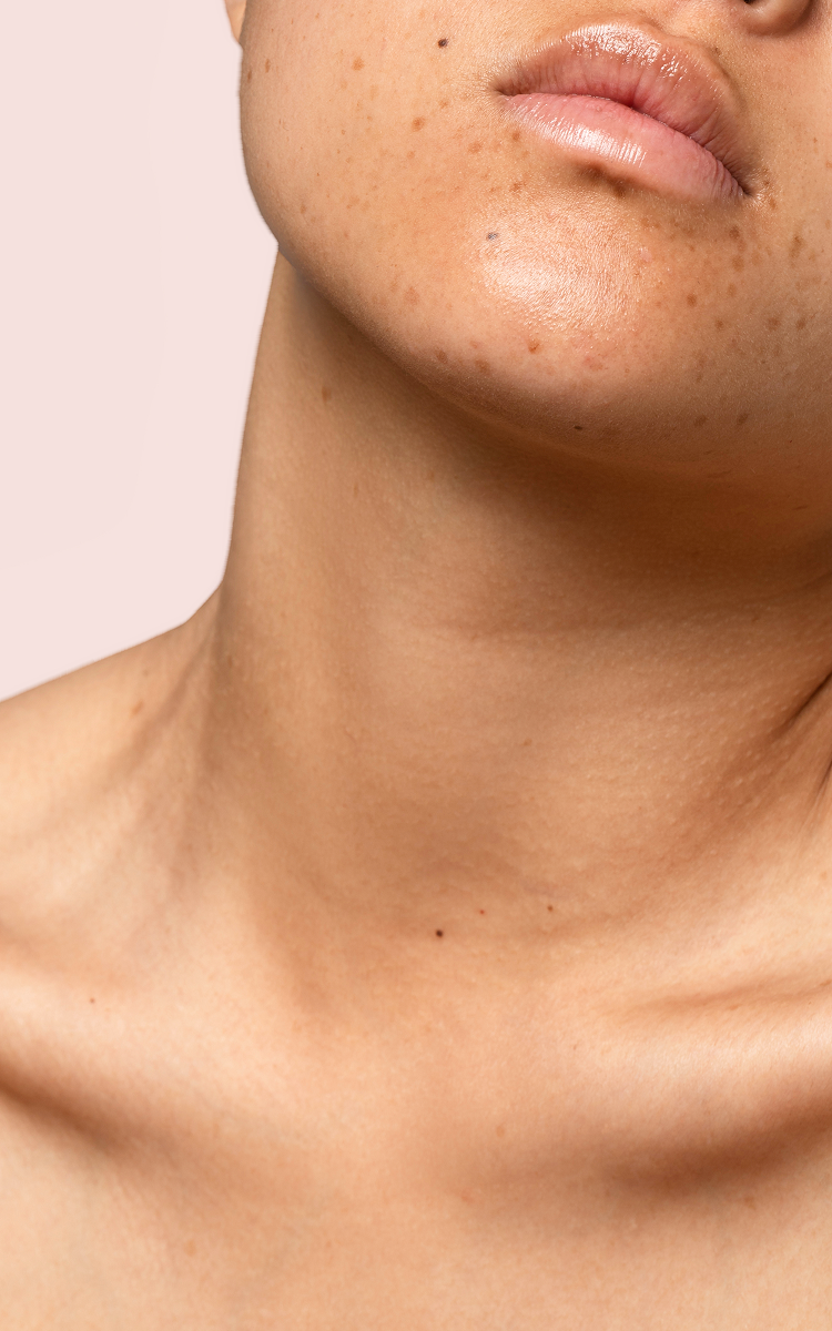 Cuello